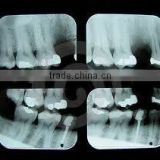 Blue Sensitive Dental X Ray Film