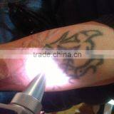 532nm Sanhe 1064nm&532nm Q Switched Nd Yag Tattoo Removal System Laser/medical Laser/1064nm&532nm Q Switched Nd Yag Laser/medical Laser thumbnail-4