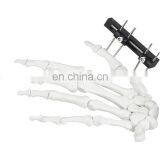 CE & ISO Marked Mini Fragment External Fixator (Finger and Palm) Surgical Instrument thumbnail-7