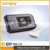 High Quality CE Approved Pocket Ultrasound Machine Hand-held Ultrasound Scanner thumbnail-1