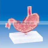 Pathological Stomach Dissection Model thumbnail-1