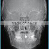 Dental X Ray Machine thumbnail-4