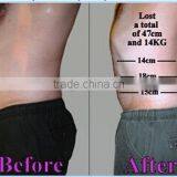 Best Price of Cryotherapy Fat Freeze Machine for Fast and Effective Cellulite Removal thumbnail-4