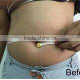 Professional Hifu Ultra Slim Body Shaper thumbnail-3