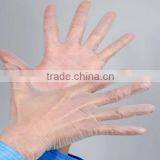 AQL1.5 FDA/CE/ISO Approved for Medical Exam / Clinic Use Vinyl Gloves thumbnail-1