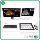 Portable Digital 15" LCD Trolley Ultrasound Scanner Price With Workstation thumbnail-4