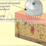 Top Selling Hifu Cavitation High Intensity Focused Ultrasound Hifu for Weight Loss thumbnail-5