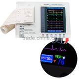 7-inch Color LCD Portable Digital 3-channel 12-lead Electrocardiograph ECG Machine EKG Machine-EKG-903A3-Shelly thumbnail-3