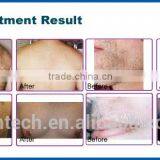 Manufacturer Supply Medical 808nm Diode Laser Hair Removal Machine/lazer Hair Removal Machine thumbnail-6