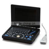 China Factory Low Price Mini Laptop Portable Ultrasound Scanner Medical Price for Obstetrics and Gynecology Examine From China thumbnail-2