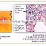 2016 Best Selling Body Slimming Beauty Machine Liposonix Machine Loss Weight thumbnail-6