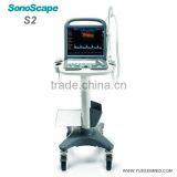 Hot Selling Medical 4d Portable Color Ultrasound Sonoscape s2