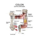 Pathology Colon Model Organs Human Body Anatomy thumbnail-4