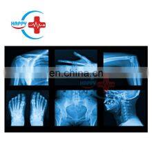 HC-D003 Newest Medical X-ray Diagnostic Equipments Portable Digital X-ray Machine For Veterinary thumbnail-3