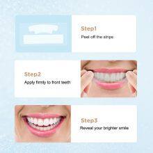 IVISMILE Teeth Whitening Strips thumbnail-5