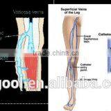 Vascular Removal Laser 980nm Laser Diode 30W Spider Vein Treatment thumbnail-5