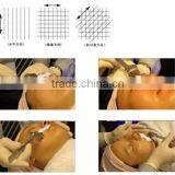 T192 Titanium Needles Micro Needle Pen for Scar Removal thumbnail-4