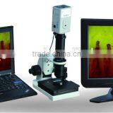 Hot New Products for Microcirculation Observation Health Analyzer Machine thumbnail-4