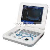 OEM Factory 10.4 Inch TFT Color LCD Laptop Portable Ultrasound Machine for Pregnancy thumbnail-3