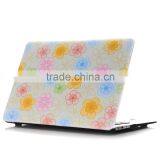 Waterproof Laptop Sticker Rubber Plastic Laptop Case Pour Ordinateur Portable Clavier thumbnail-6