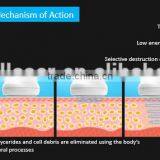 8MHz 2016 Body Shape Fastest Weight Loss Chest Shaping Slimming Liposonix HIFU Portable Ultrashape Cavitation Machine High Frequency Beauty Machine thumbnail-5