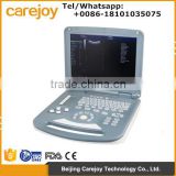 Laptop 15 inch LCD Color Doppler Ultrasound Diagnostic System RUS-9000-2 with CE ISO approved