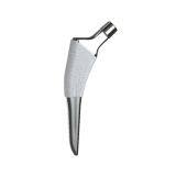 Bone Preservation Stem Replacement thumbnail-1