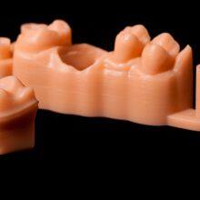 Digital-Crowns-Bridges Chinese Dental Lab Denture thumbnail-3