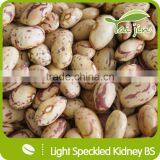Edible Light Speckled Kidney Beans For Canning thumbnail-2
