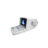 Portable Ultrasound Scanner----CE Approved Ultrasound Machine thumbnail-1