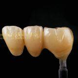 Dental Crown Zirconia Cercon,dental Teeth,dental Prosthesis Laboratoire Dentaire, Dentallabor, Laboratorio Dental, Dental Laboratory, Shenzhen LJ Dental Lab thumbnail-3