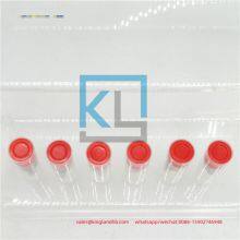 High Quality Engine Parts 1104C Nozzle L130PBA Suitable for PERKINS thumbnail-4