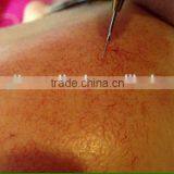 Eye Wrinkle Removal/medical C2P Co2 Gas Cartridges Carboxytherapy CDT Beauty Machine thumbnail-2