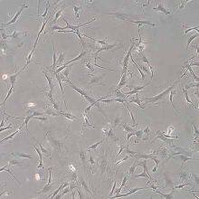 Inverted Biological Microscope With Phase Contrast MI52-N thumbnail-2