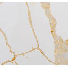 Code：1101，Calacatta Artificial Stone Quartz Slab Kitchen Countertops thumbnail-2
