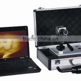 TR5000 Series Infrared Mammary Tester