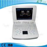 LTS-10 China Portable Ultrasound Machine Price for Pregnancy