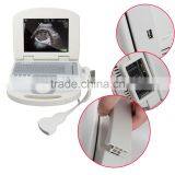 Medical Devices Digital Clear Imaging Portable Ultrasound Machine for Pregnancy thumbnail-1