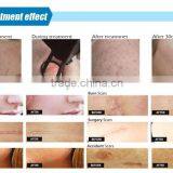 2016 CE Approved Verticalsuper Pulse Co2 Fractional Laser for Laser Scar thumbnail-4