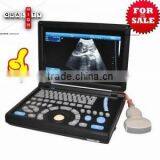 High Quality Cheap Price of Portable/Notebook/Laptop Ultrasound Scanner/machine With Convex, Linear, Vaginal, Rectal Transducer- thumbnail-1