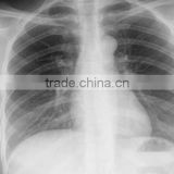 China radiographie pulmonaire film KND-A/F CE