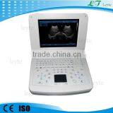 LTS-10 Portable Laptop Ultrasound Scanner USG Machine