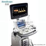 Trolley Color Doppler Machine 3D 4D Sonoscape S20 Price