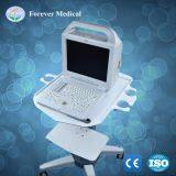 PC Based Medical System Digital Portable Ultrasound Scanner thumbnail-4