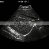 UProbe-20 Probe Type Ultrasound Scanner for Laptop thumbnail-4