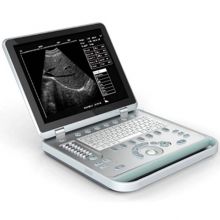AG-BU007 Digital hospital equipment examination veterinary vet hand held ultrasound scanner portable ultrasound scanner for vet
