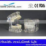 Dental Standard Transparent Dentition Model DEA-46 thumbnail-2