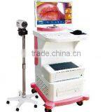 Digital Video Colposcope, Laptop Video Colposcope, Gynecology Video Colposcope thumbnail-6
