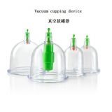 Cupping device