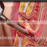 OEM Multifunction Clinical/medical/hospital Laser Vaginal Tightening Machine thumbnail-5